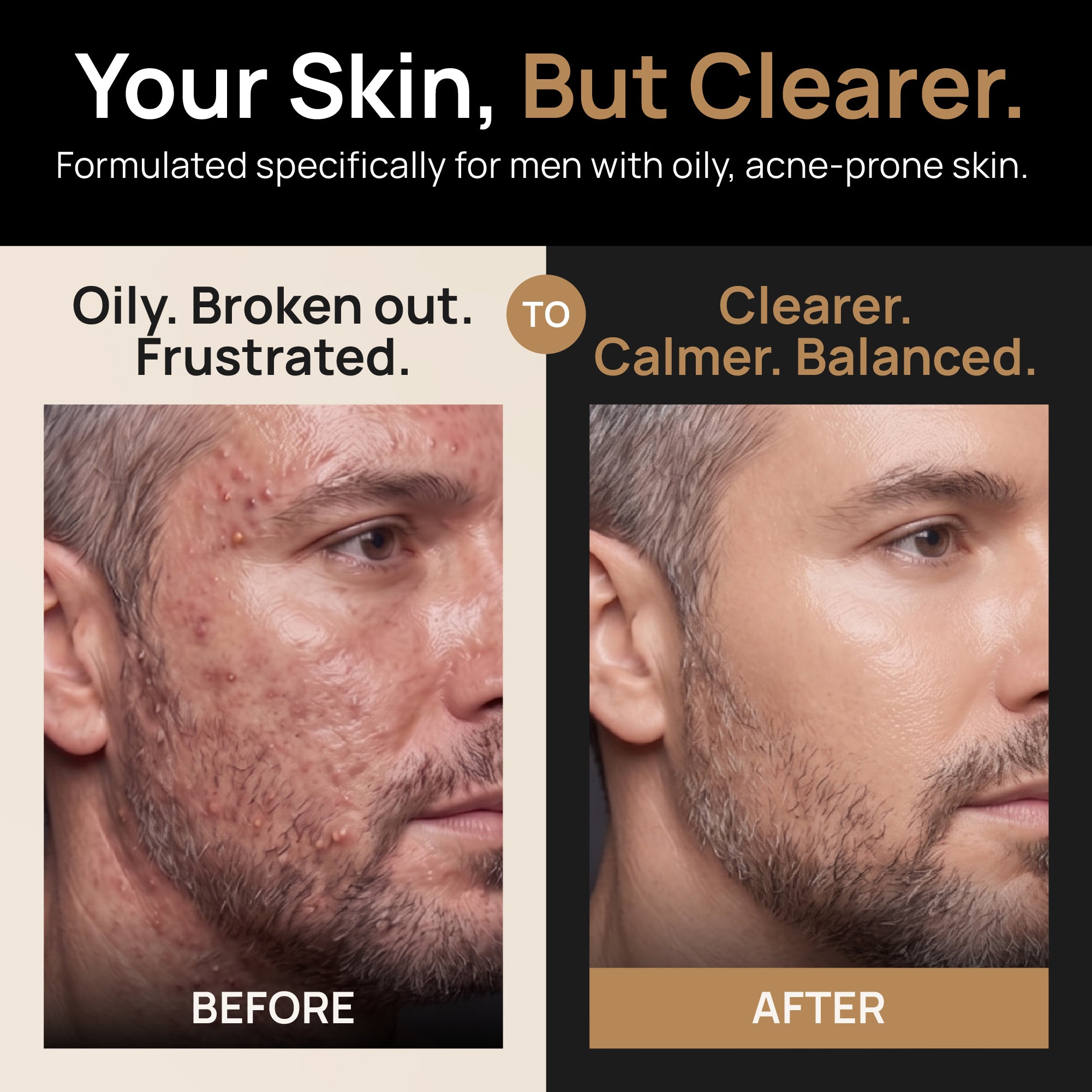 Clear Skin Tallow