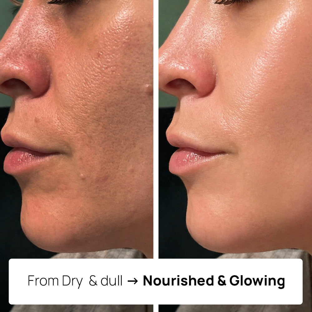 Moisturizing Tallow Cream